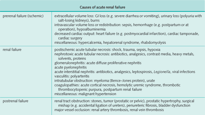 Causes of Acute Renal Failure
