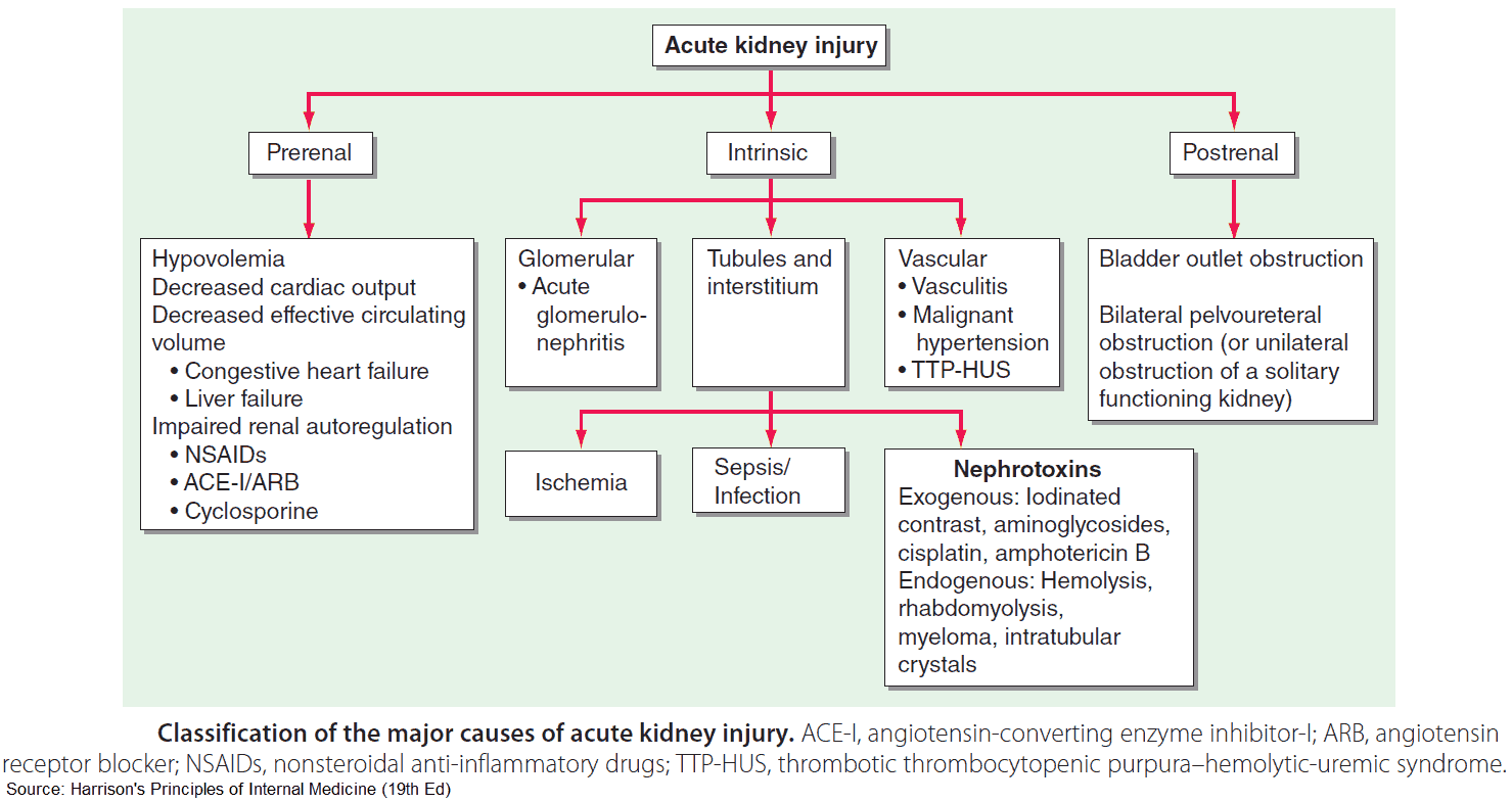 Classification of the major causes of acute kidney injury