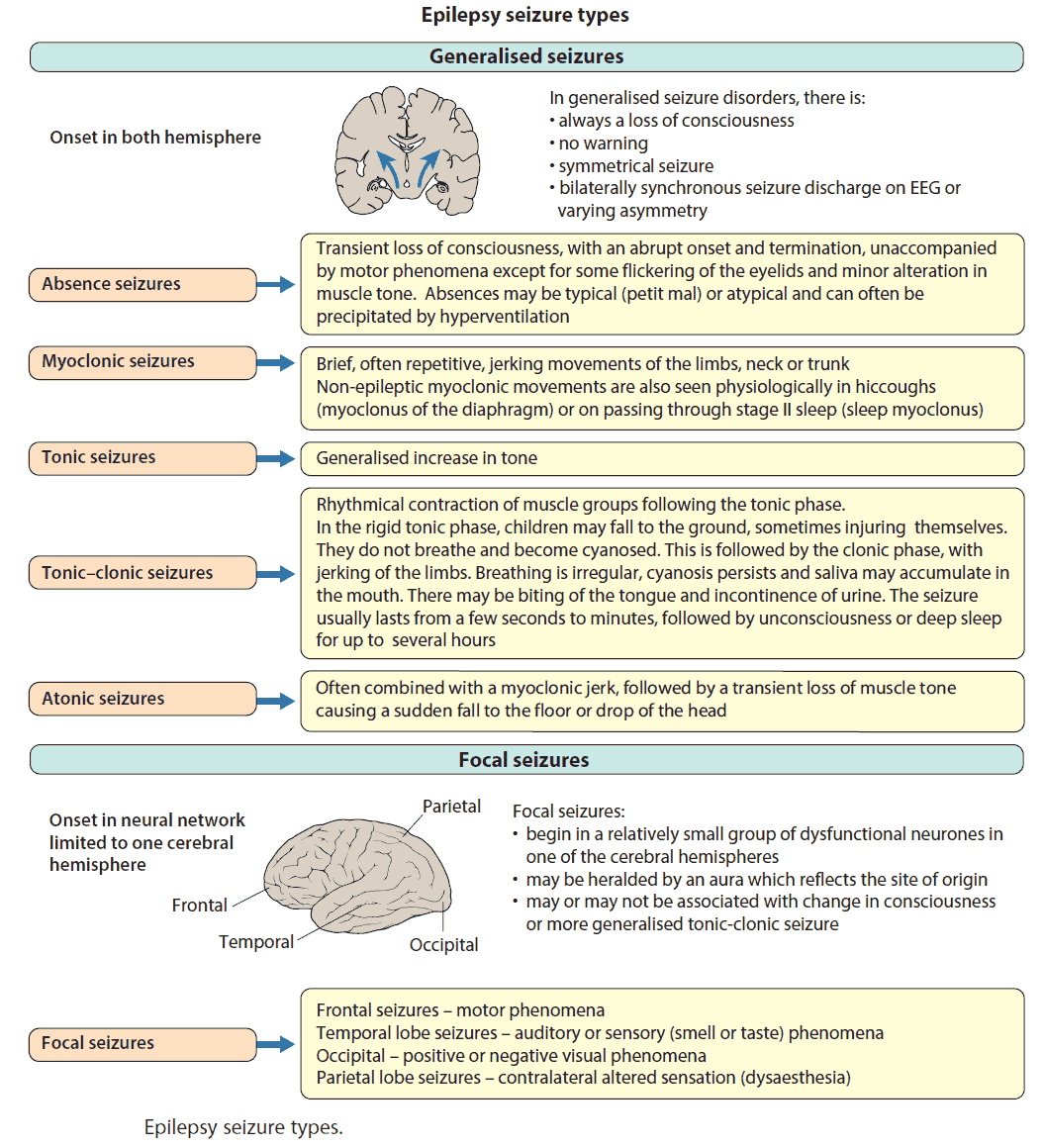 Epilepsy seizure types, classification and symptoms