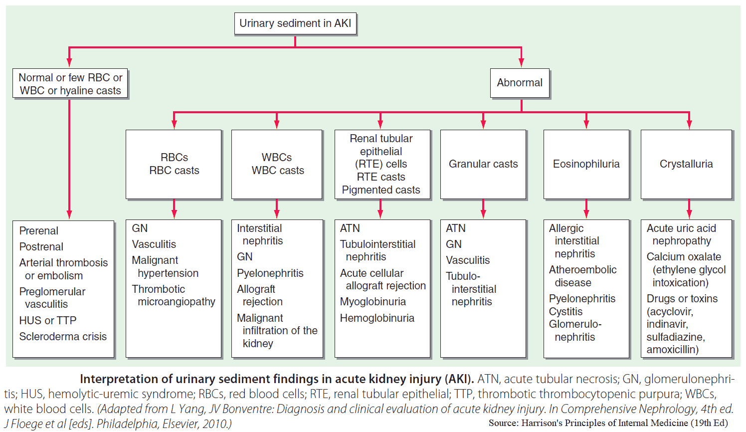 Interpretation of urinary sediment findings in acute kidney injury (AKI)
