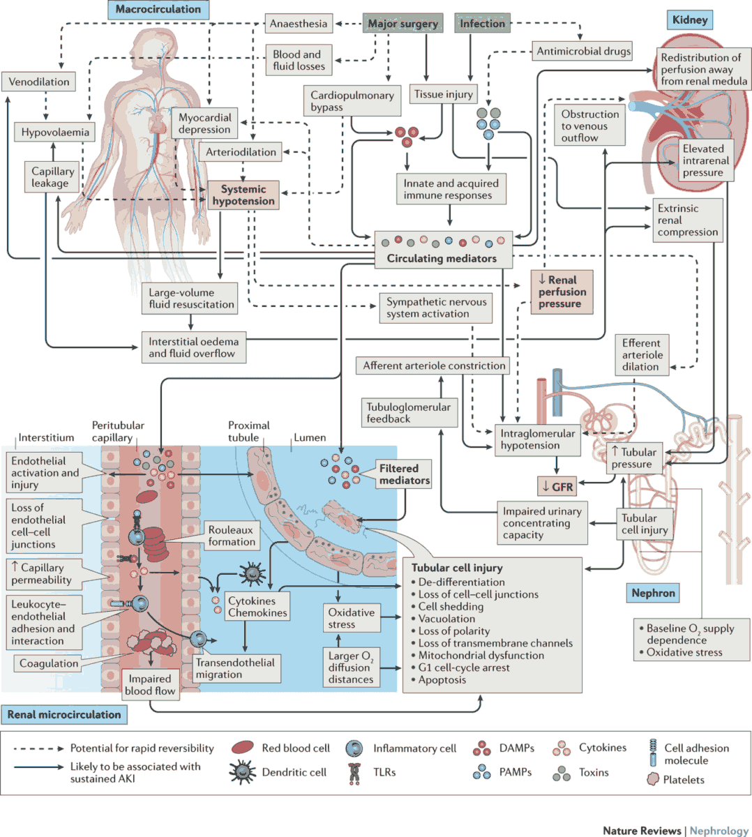 Principal Pathophysiologic Mechanisms of Acute Kidney Injury in the Context of Sepsis or Major Surgery