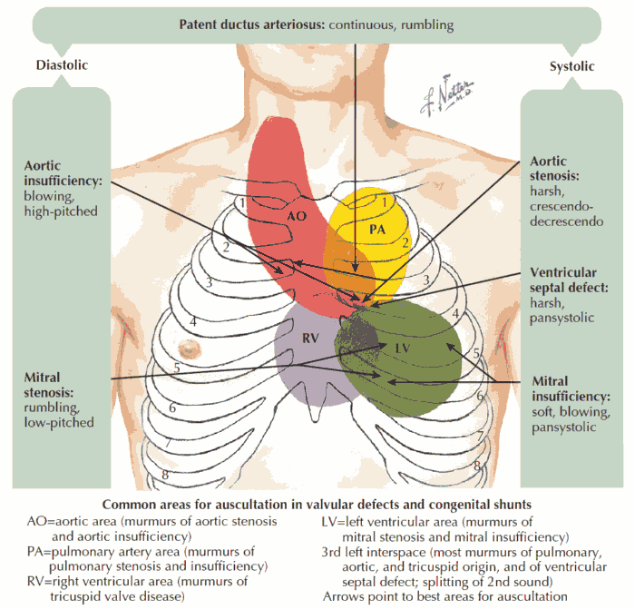 Figure From The Physiology Of Cardiac Semantic Scholar 45 OFF