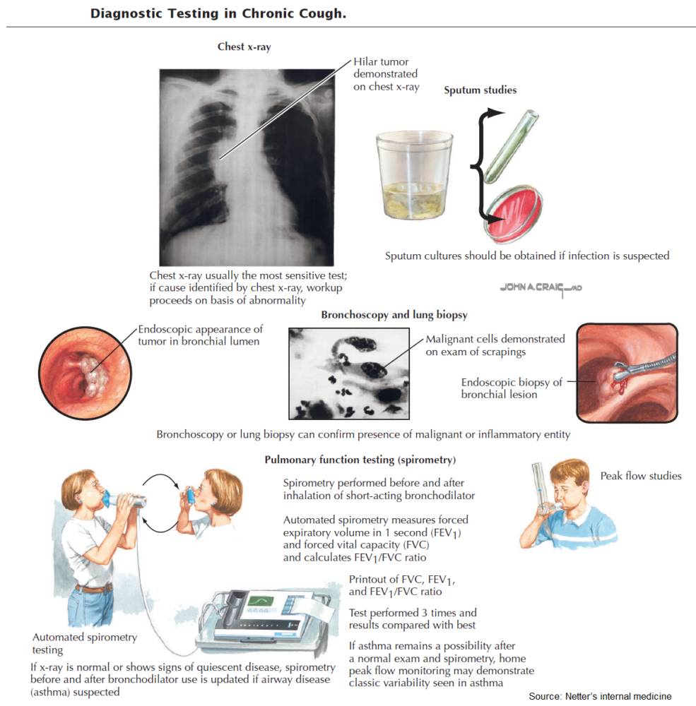 Diagnostic Testing in Chronic Cough