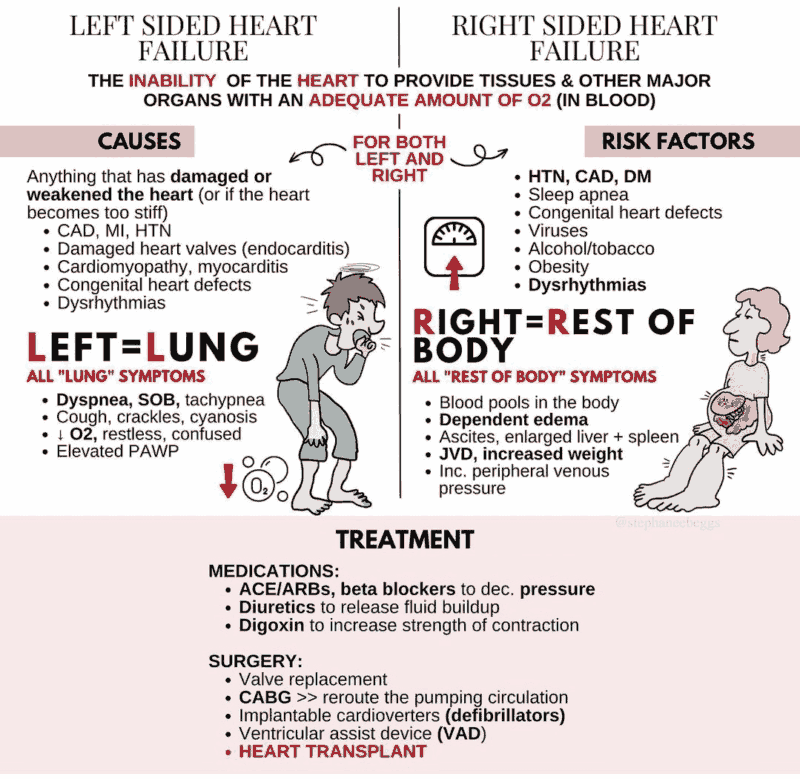 Left vs Right Sided Heart Failure - Summary