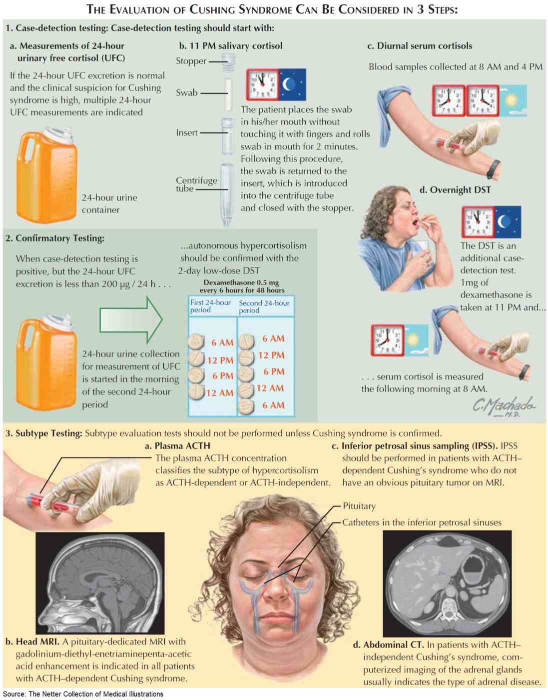 Tests Used in the Diagnosis of Cushing Syndrome