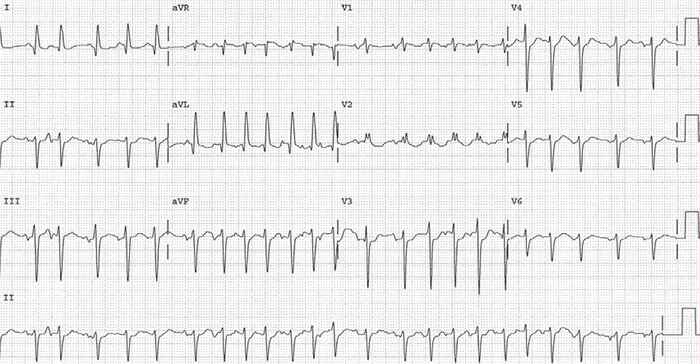 Read more about the article ECG Case 177