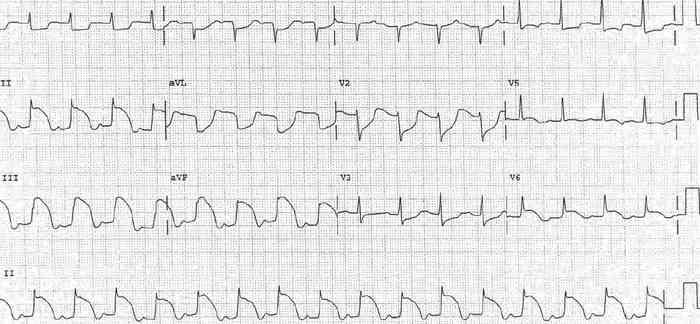 Read more about the article ECG Case 179