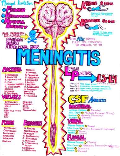 Read more about the article Diagnosing and Treating Meningitis