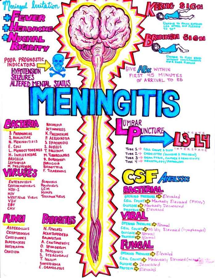 Meningitis - Summary