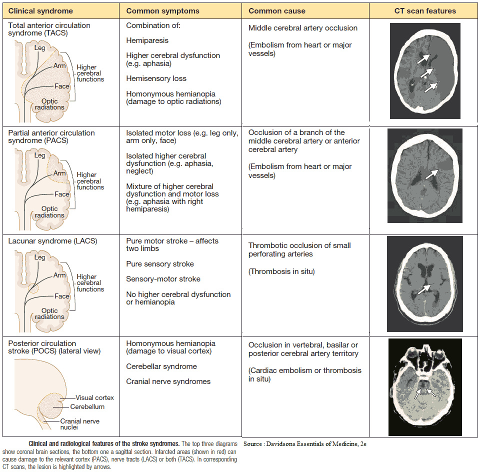 Clinical and Radiological Features of the Stroke Syndromes