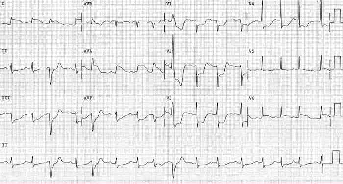 Read more about the article ECG Case 182