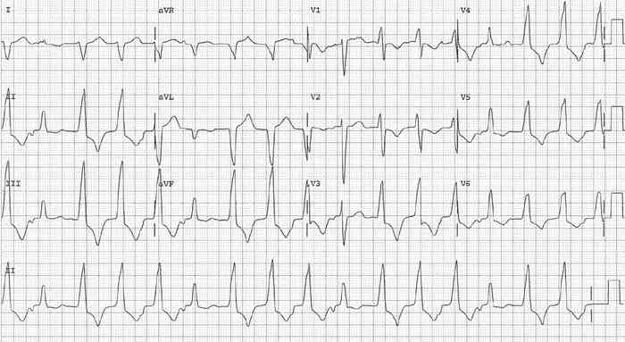Read more about the article ECG Case 184