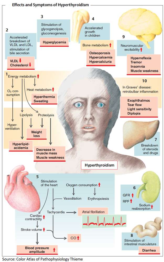 Effects, Symptoms and Signs of Hyperthyroidism