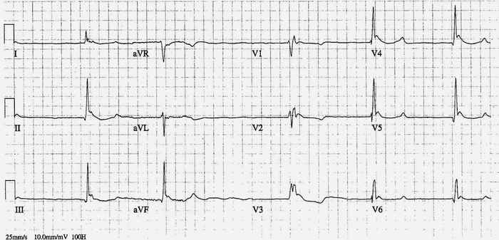 Read more about the article ECG Case 187