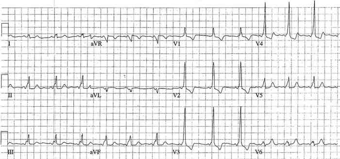 Read more about the article ECG Case 188