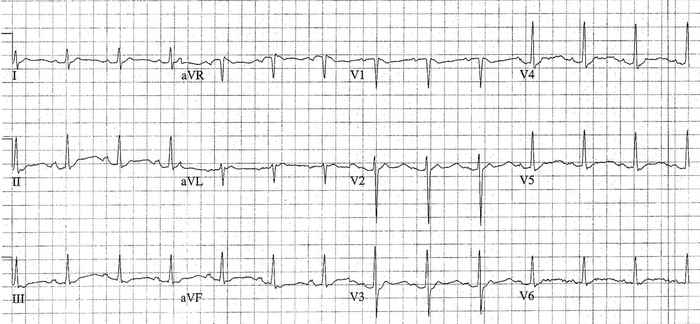 Read more about the article ECG Case 189