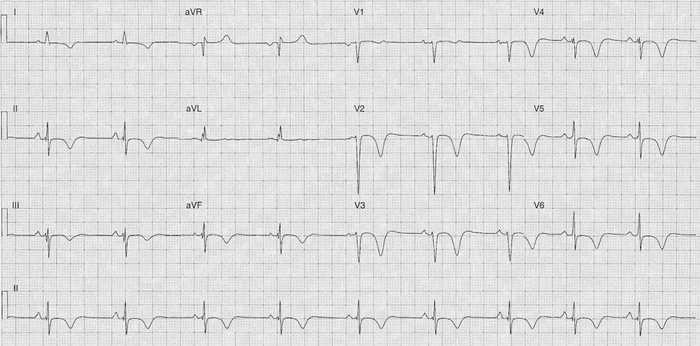 Read more about the article ECG Case 192