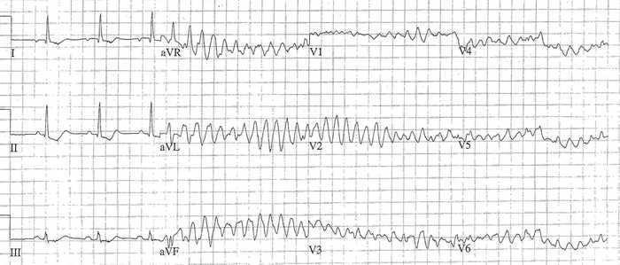 Read more about the article ECG Case 195