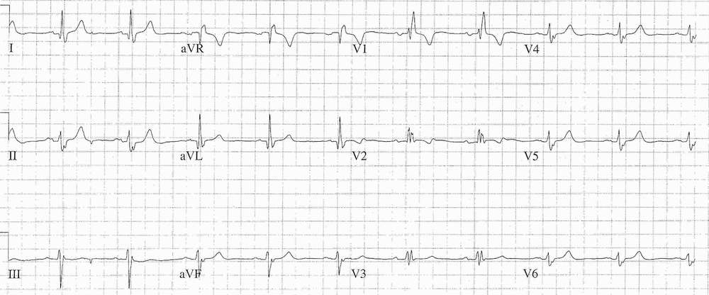 Read more about the article ECG Case 196