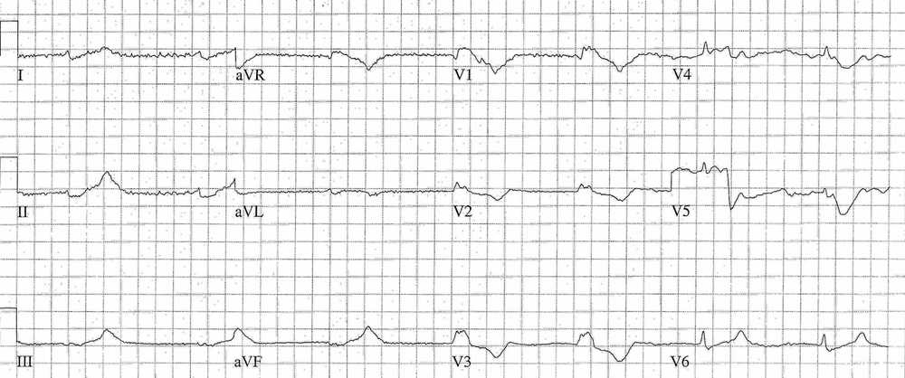 Read more about the article ECG Case 197