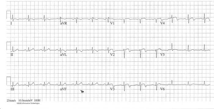 Read more about the article ECG Case 199