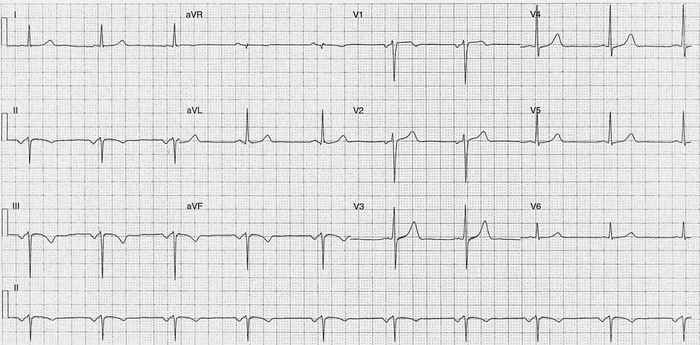 Read more about the article ECG Case 208