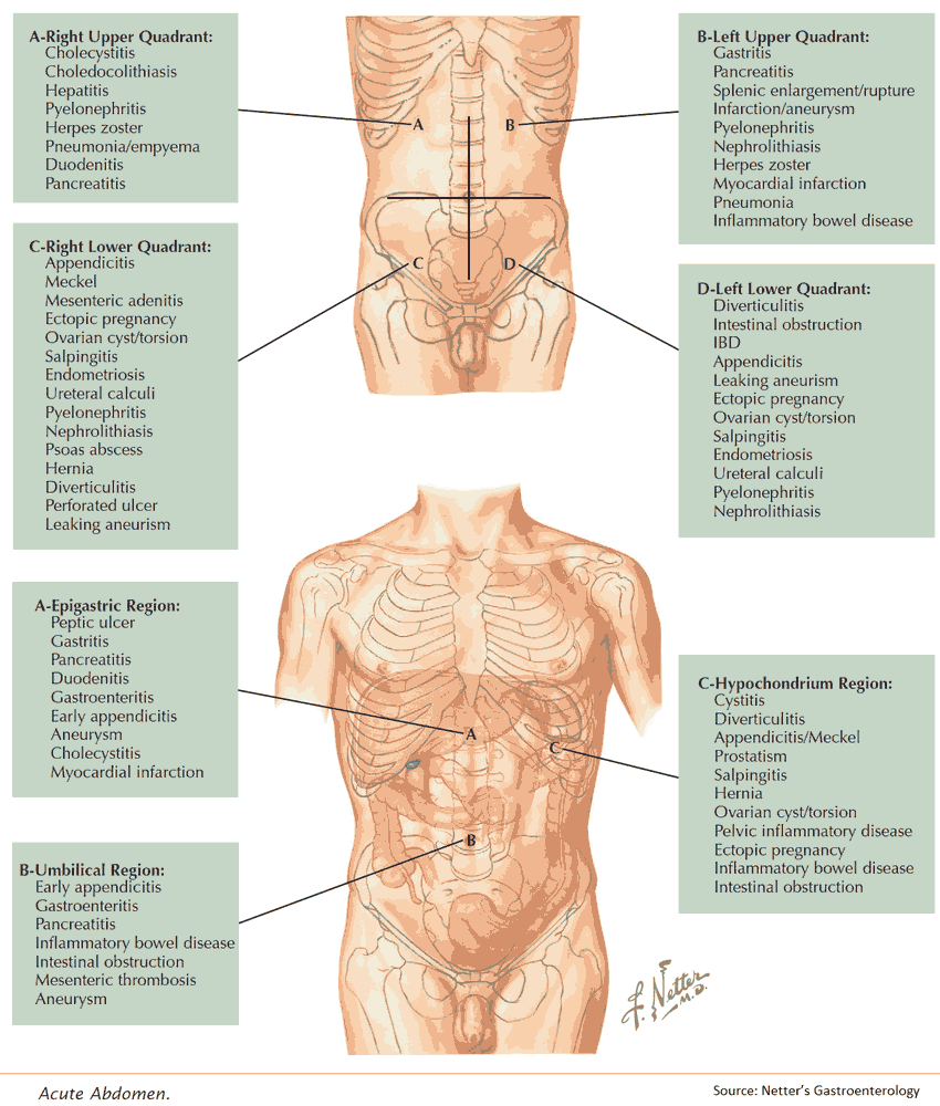 Causes of Acute Abdominal Pain by Location
