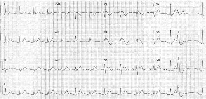 Read more about the article ECG Case 210