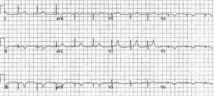 Read more about the article ECG Case 214