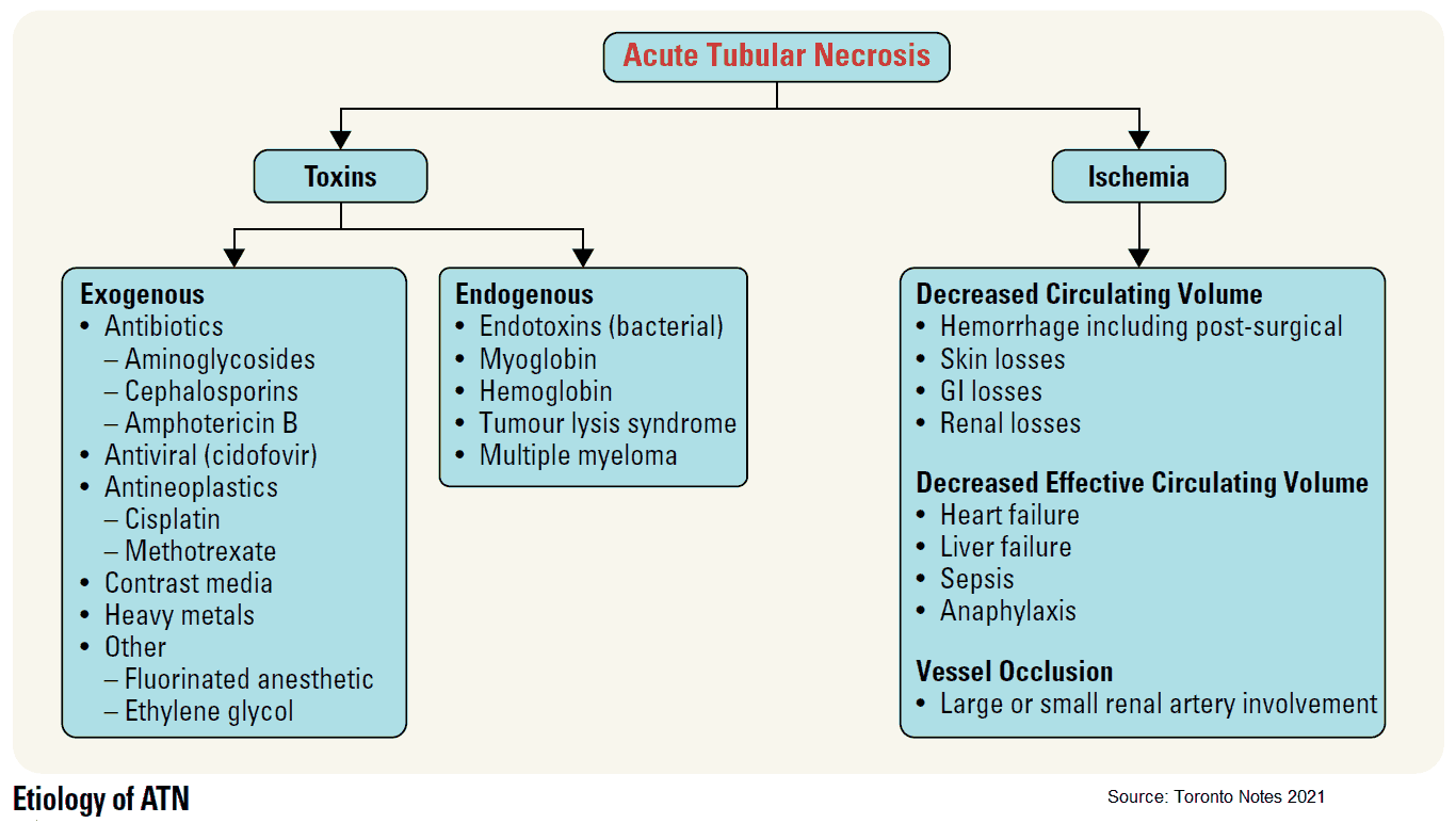 Etiology of Acute Tubular Necrosis (ATN)