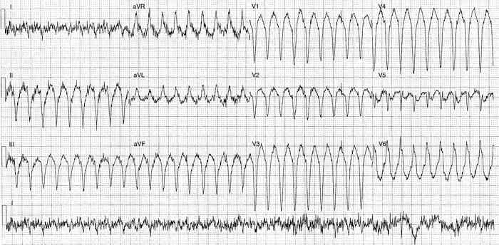 Read more about the article ECG Case 220
