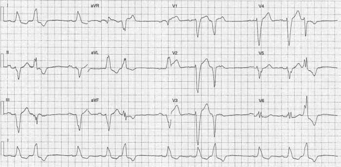 Read more about the article ECG Case 226