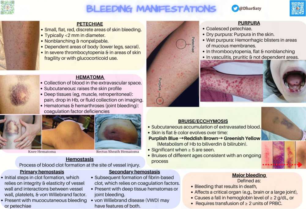 Bleeding Manifestations