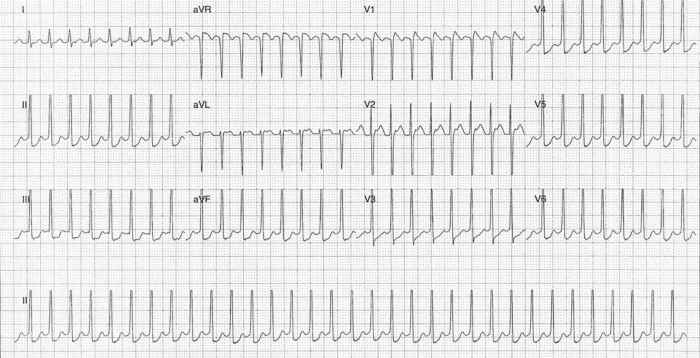 Read more about the article ECG Case 231