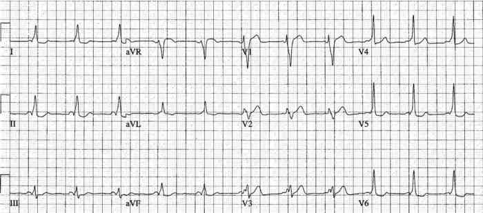 Read more about the article ECG Case 232