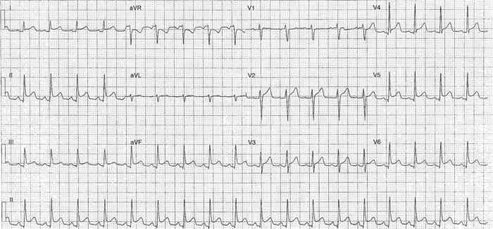 Read more about the article ECG Case 235