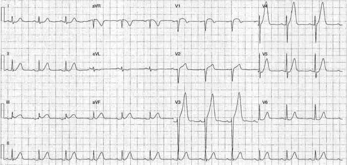 Read more about the article ECG Case 240