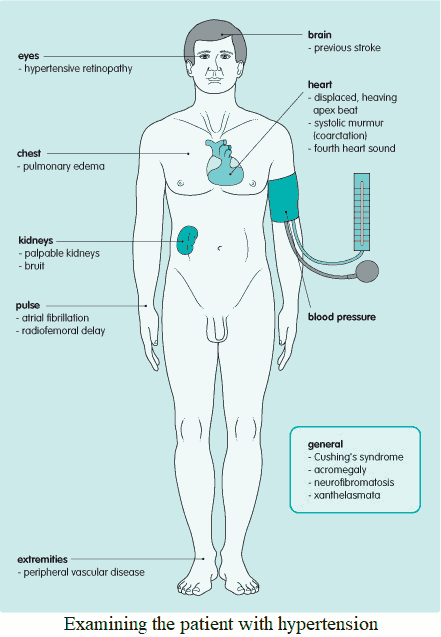 Examining the patient with arterial hypertension