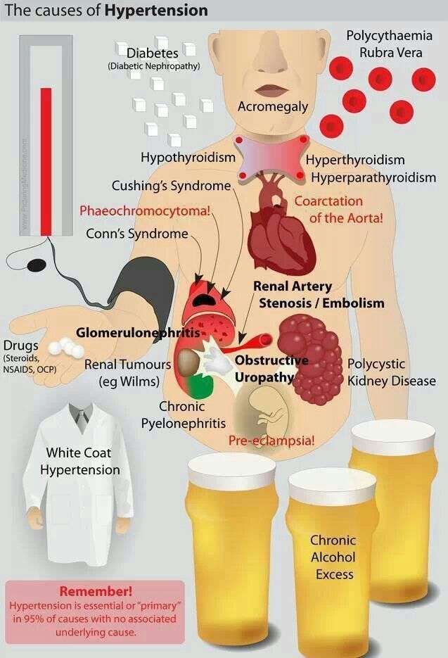 The Causes of Arterial Hypertension