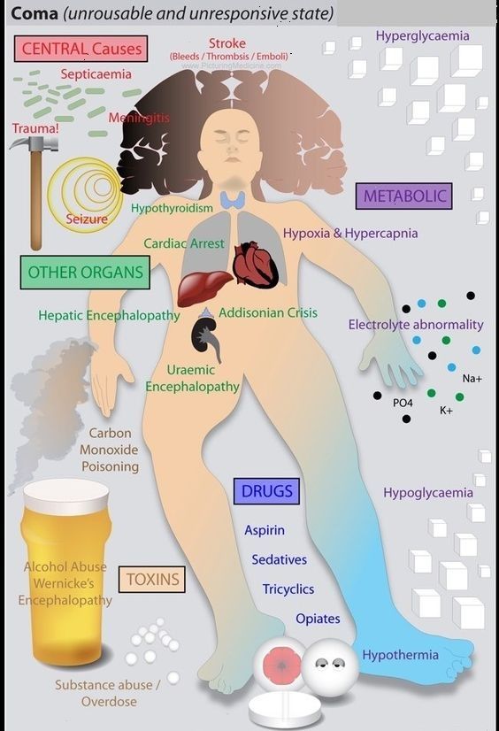 Coma - Causes