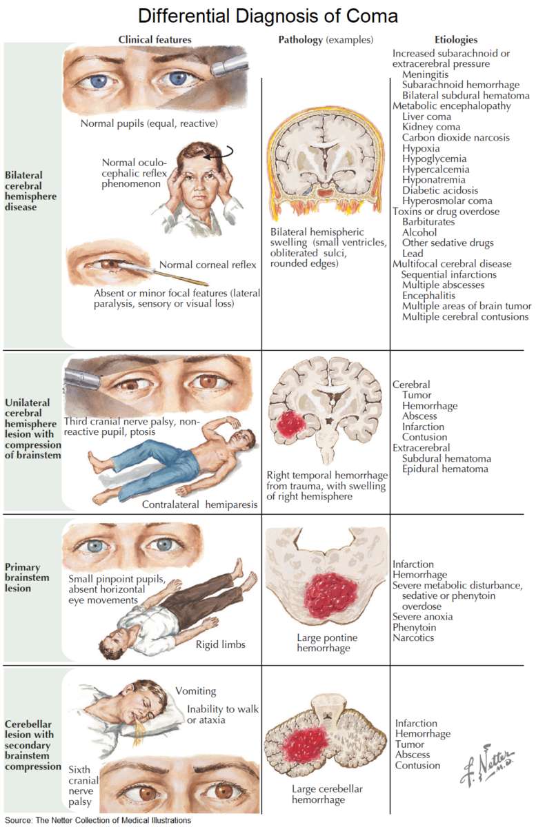 Causes and Differential Diagnosis of Coma