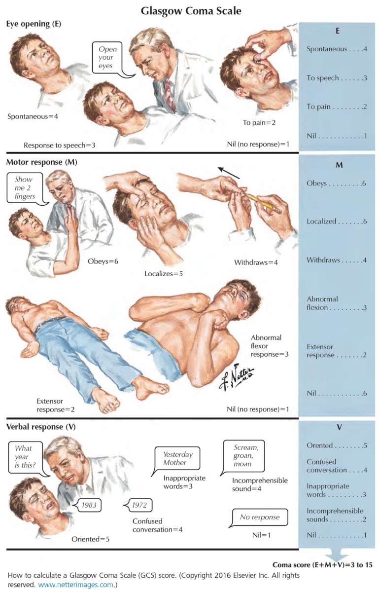 How to calculate a Glasgow Coma Scale (GCS) score