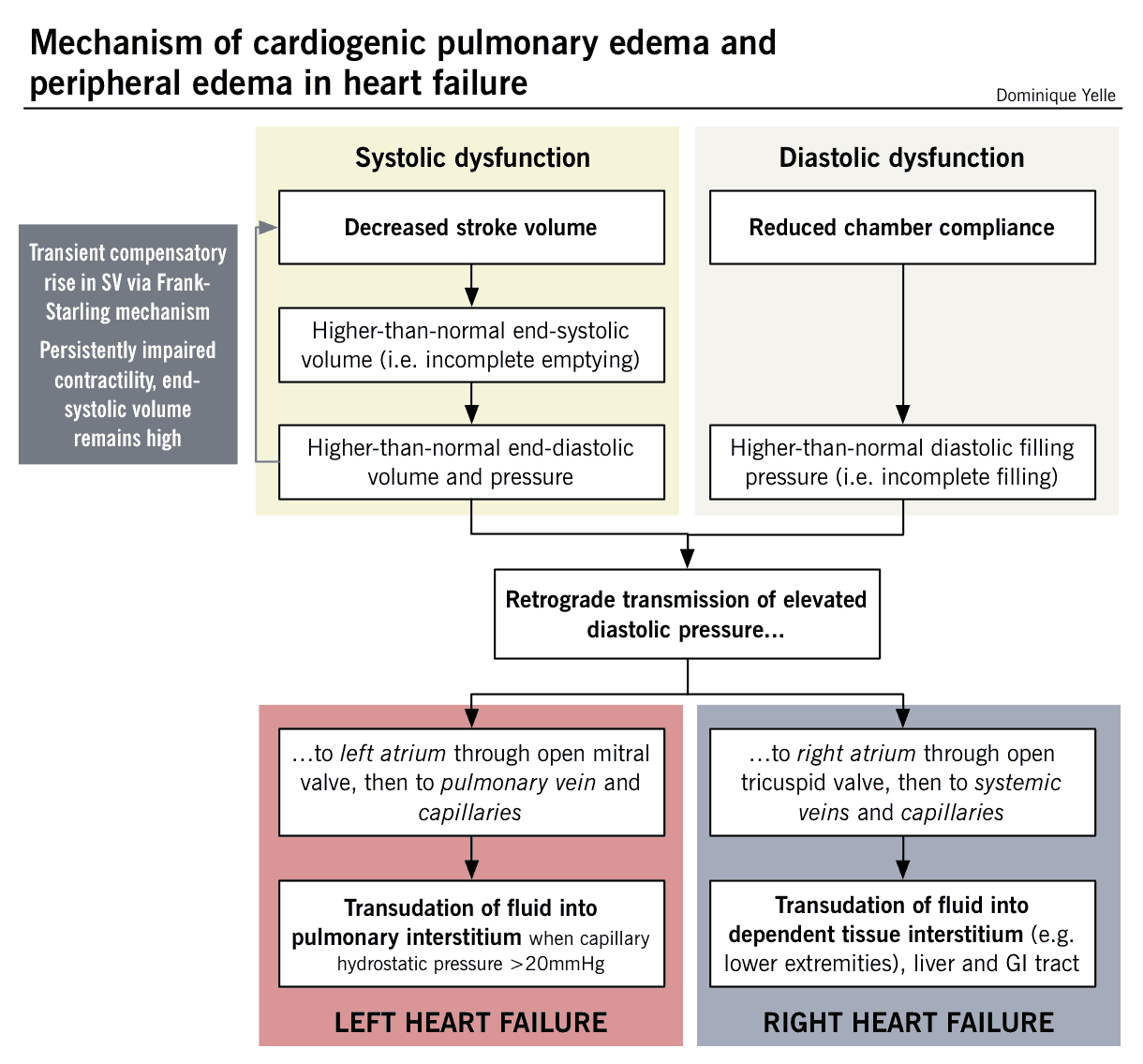 Mechanism of cardiogenic pulmonary edema and peripheral edema in Heart Failure