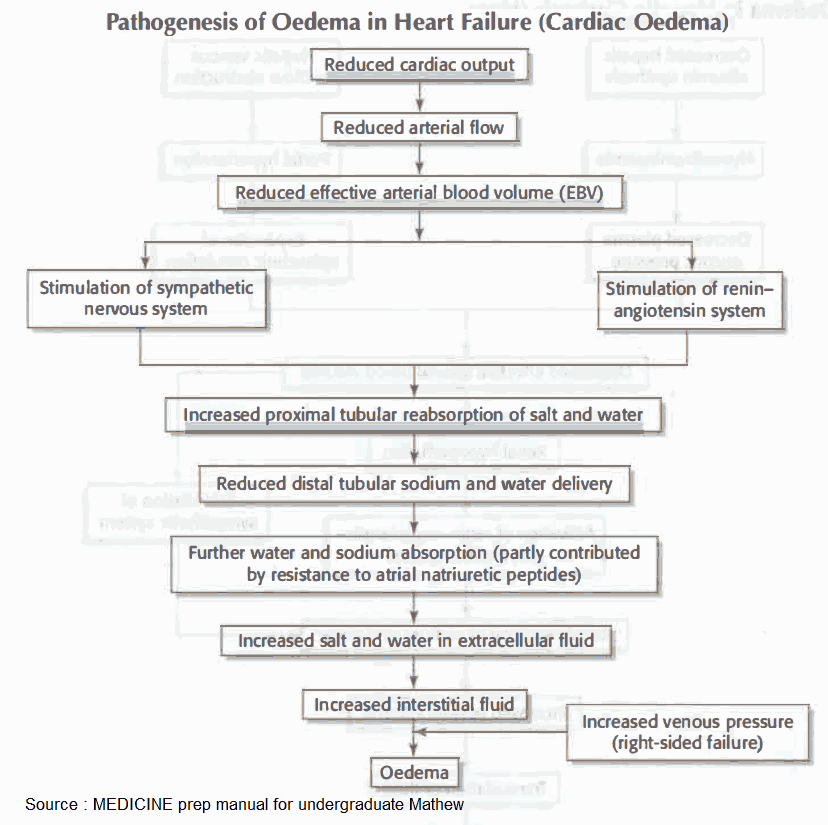 Pathogenesis of edema in Heart Failure (Cardiac edema)