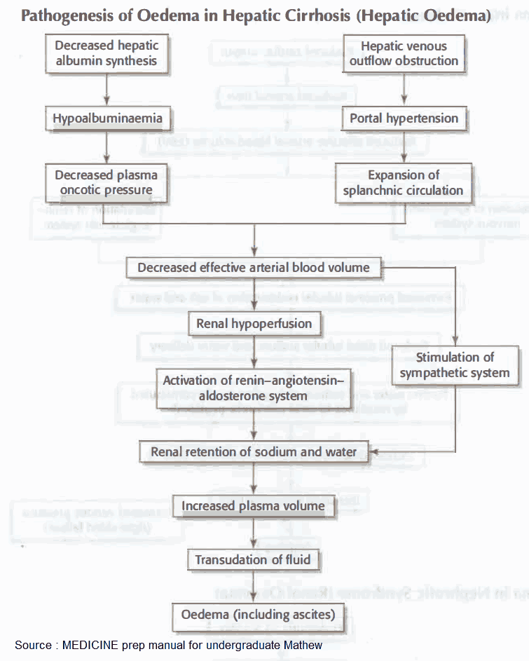 Pathogenesis of edema in Hepatic Cirrhosis (Hepatic edema)