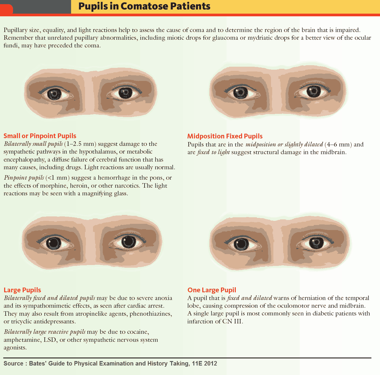 Pupils in Coma and Comatose Patients