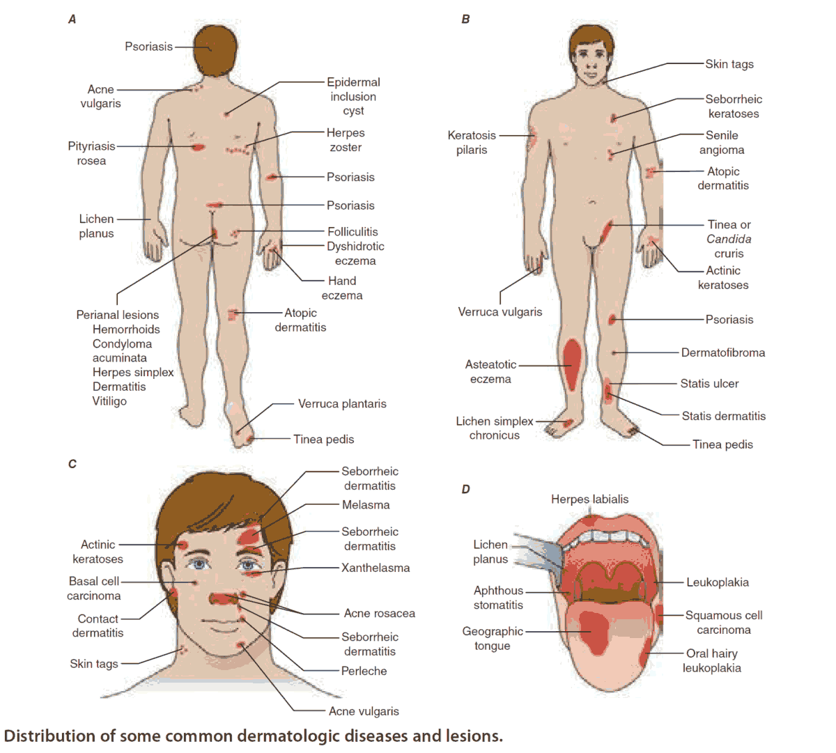 Distribution of some common dermatologic diseases, skin rashes and lesions