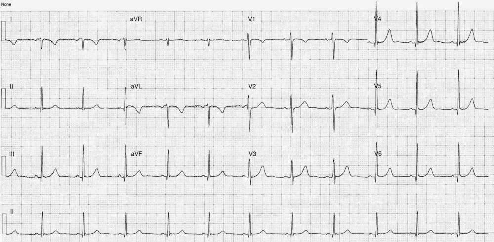 Read more about the article ECG Case 247