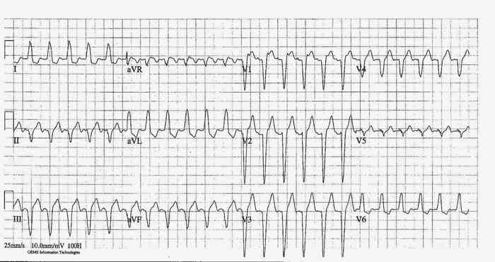 Read more about the article ECG Case 249