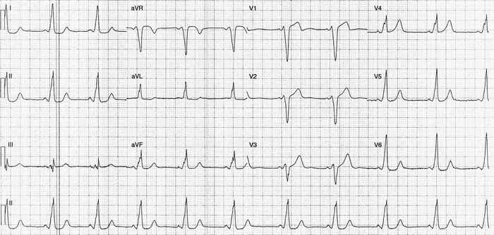 Read more about the article ECG Case 250